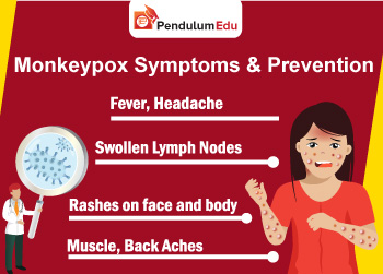 Monkeypox Symptoms and Treatment